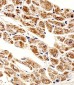 ZNF175 Antibody (N-term)